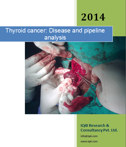 Thyroid cancer